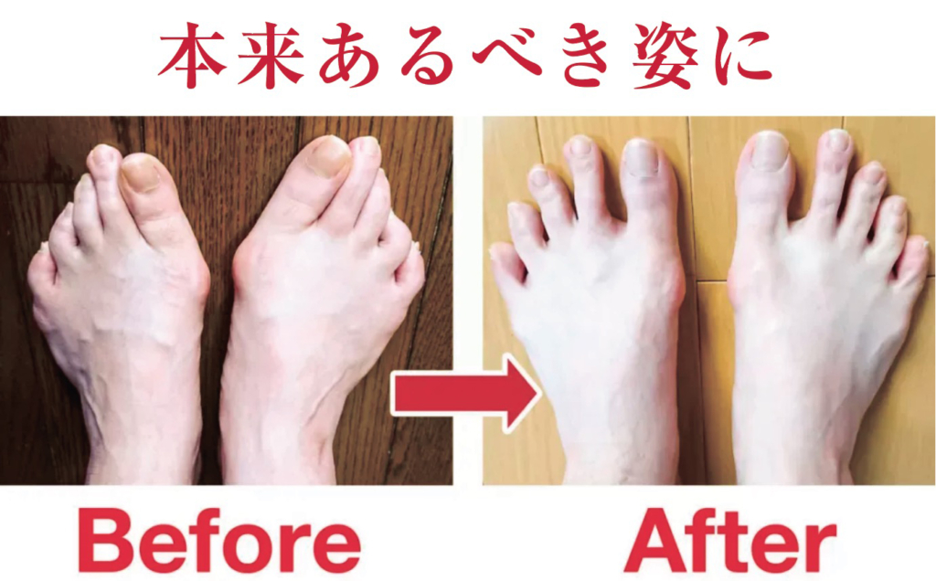 足の悩みを吹き飛ばす！常識破りの日本式フットケア。靴が合わない、足が痛い、歩くのがつらい…全部まとめて根本解決！
