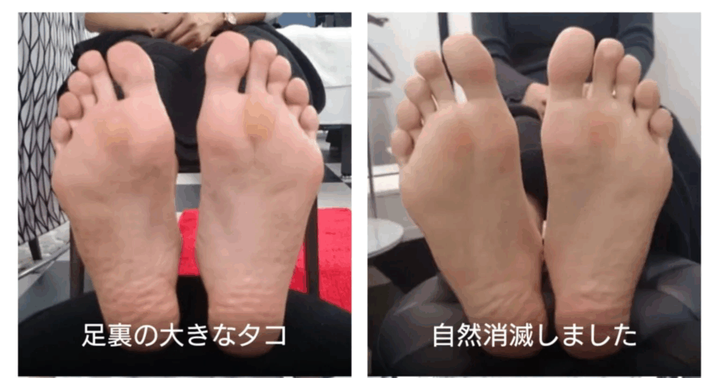 タコが自然消滅